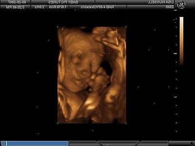 Hur man tolkar en graviditet ultraljud