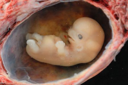 I en normal graviditet ultraljud. Biparietal diameter bebis.